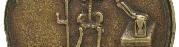 Chirurgijnspenning